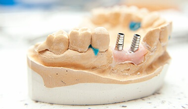 Woman smiling after dental implant restoration