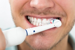 Animated smiling during tooth colored filling treatment