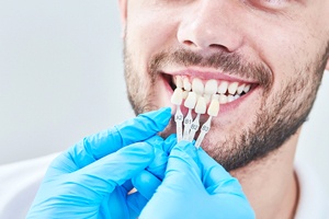 Smile compared to porcelain veneer options