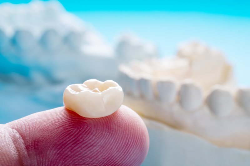 Model of dental crown in Gahanna